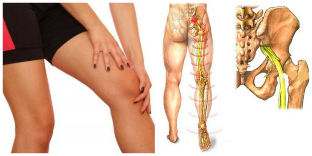 Rückenschmerzen und Bein-Behandlung