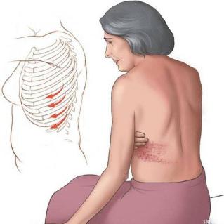 Schmerzen die rippen vom Rücken Ursachen