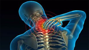 Ursachen der Osteochondrose des Halses